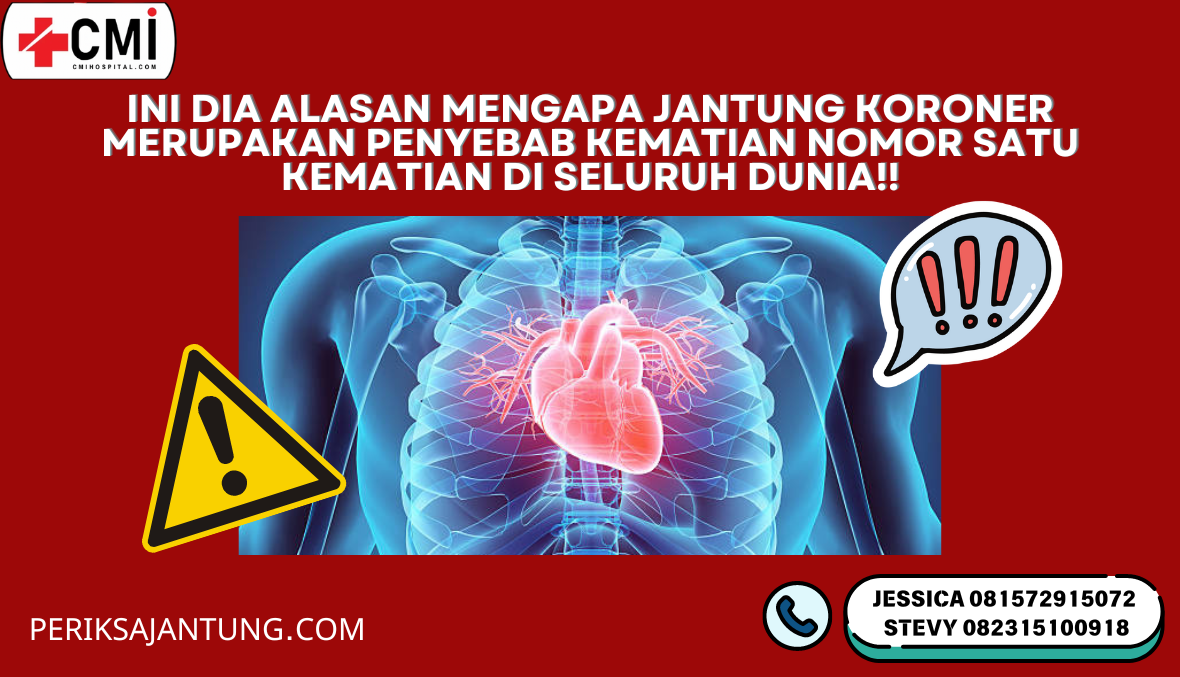 Ini Dia Alasan Mengapa Jantung Koroner Menjadi Penyebab Kematian Nomor 1 Kematian di Seluruh Dunia